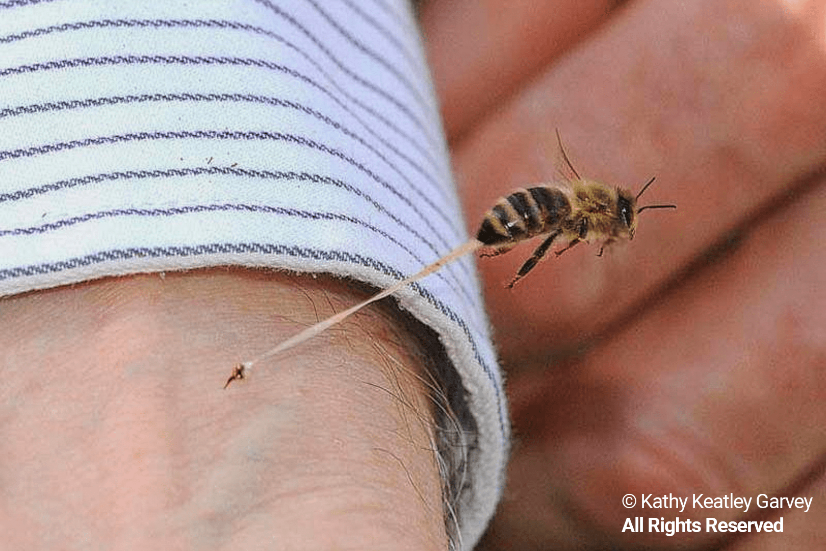 How Long Should a Bee Sting Itch?