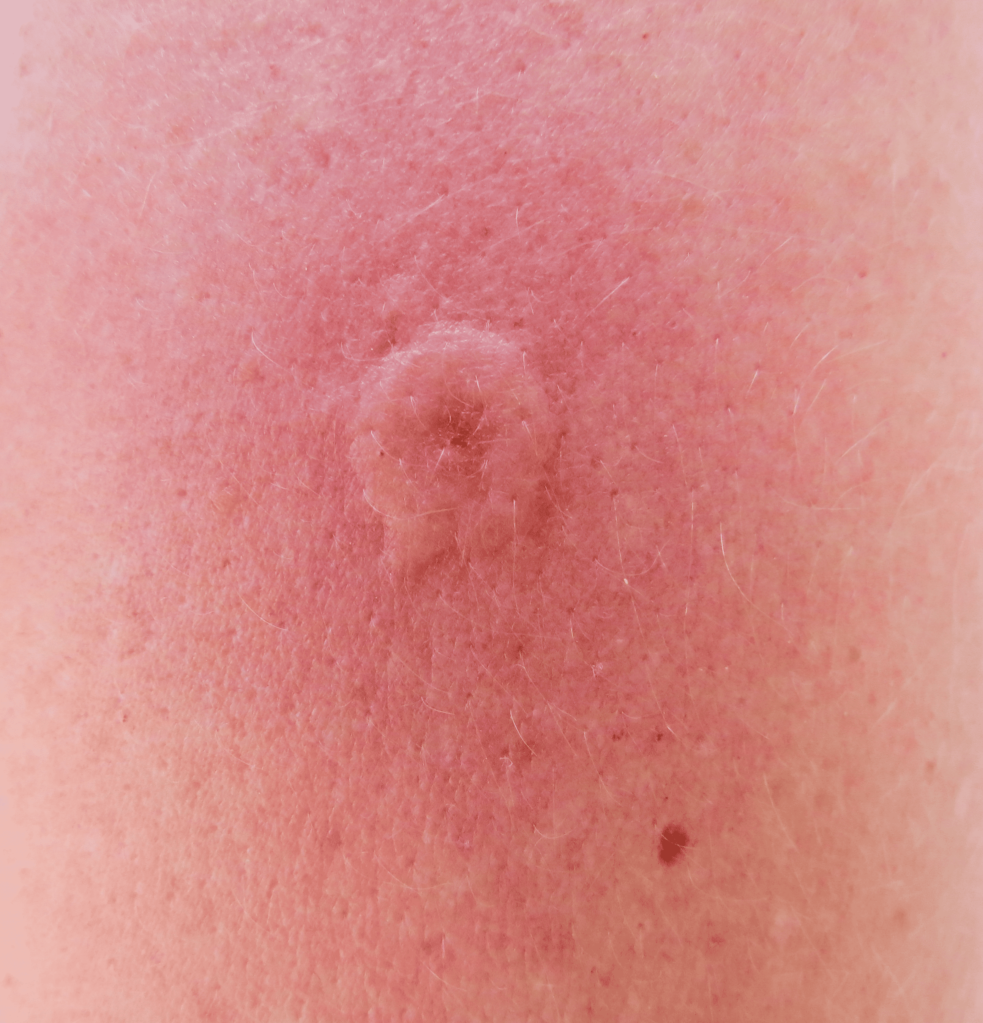 wasp-sting-here-s-what-you-need-to-know-beeswiki